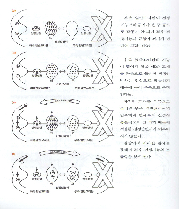 빙빙 윤승일 원장의 어지럼증 없는 세상 알기 쉬운 어지럼증의 진단과 치료 