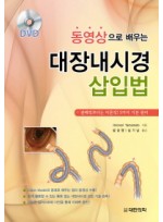 동영상으로 배우는 대장내시경 삽입법-관례적보다는 이론적! 3가지 기본 원리