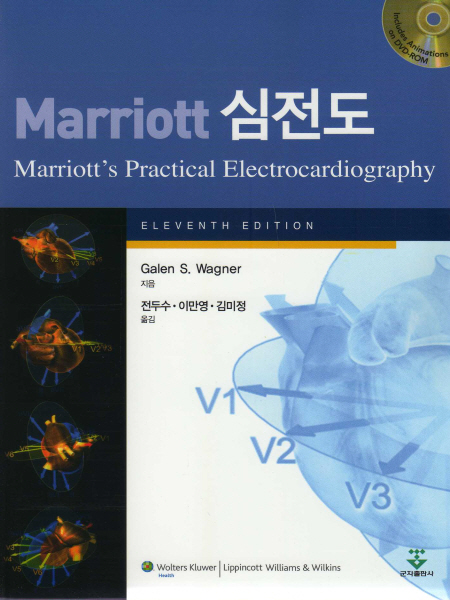  Marriott 심전도 (CD포함) 11판