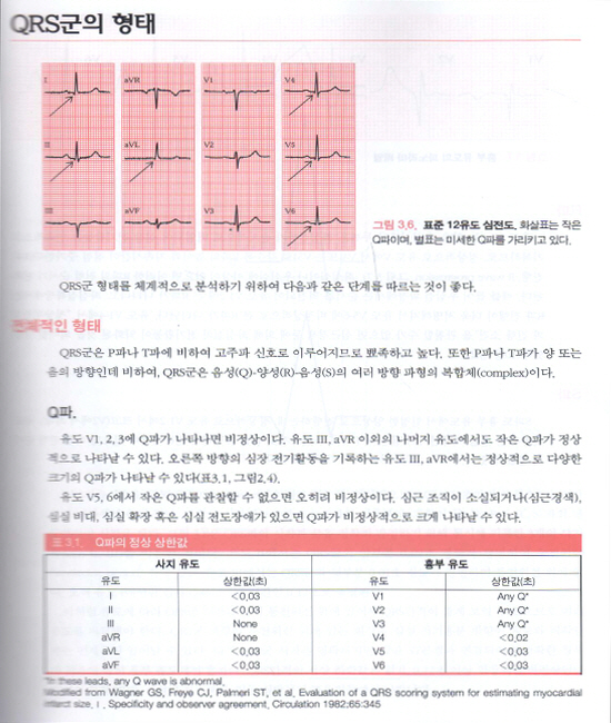  Marriott 심전도 (CD포함) 11판