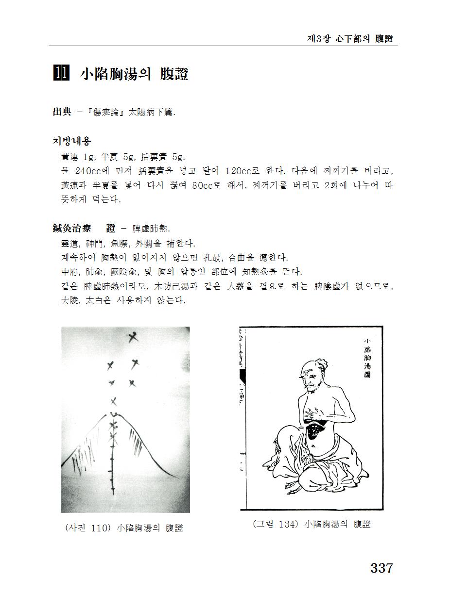 임상고금복증신람