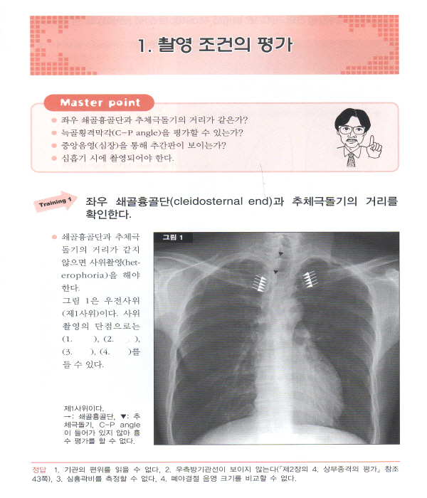 단계별로 이해하는 흉부 X선 영상진단 ABC [양장본] 