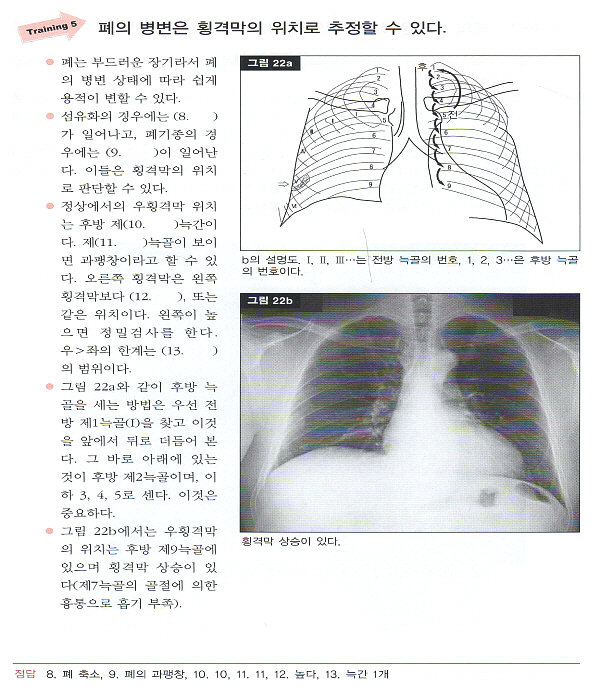 단계별로 이해하는 흉부 X선 영상진단 ABC [양장본] 