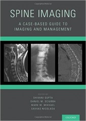 Spine Imaging: A Case-Based Guide to Imaging and Management