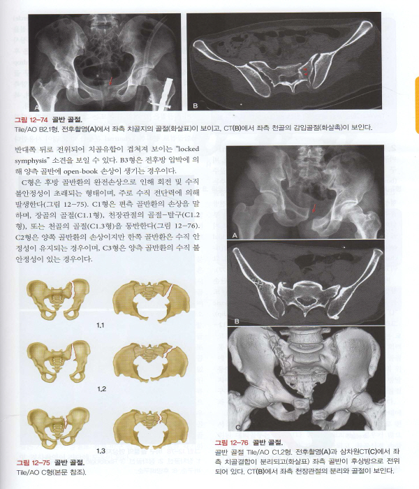 근골격 영상의학 Musculoskeletal Radiology