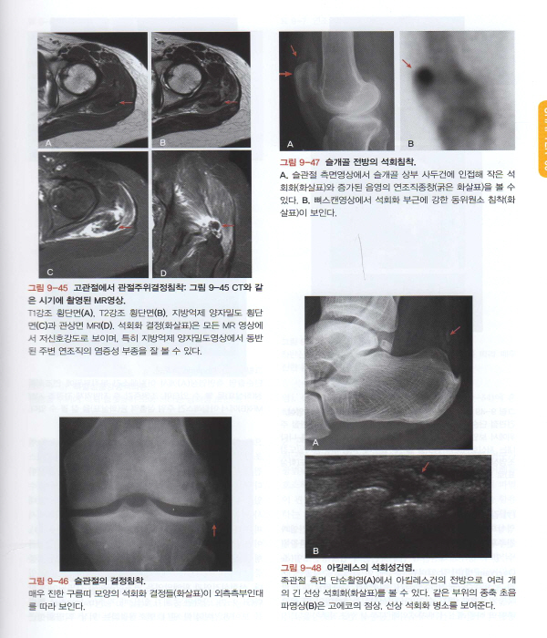 근골격 영상의학 Musculoskeletal Radiology