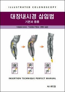 대장내시경삽입 기본과 응용 