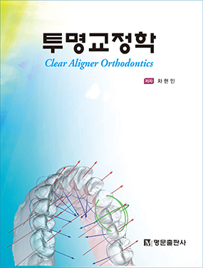 투명교정학 ( Clear Aligner Orthodontics) 