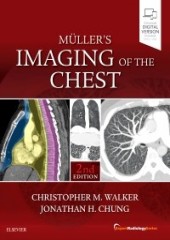 Muller's Imaging of the Chest, 2/e