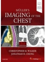 Muller's Imaging of the Chest, 2/e