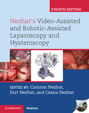 Nezhat's Video-Assisted & Robotic-Assisted Laparoscopy & Hysteroscopy,4/e with DVD