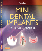 MINI DENTAL IMPLANTS; Principles and Practice 