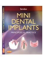 MINI DENTAL IMPLANTS; Principles and Practice 