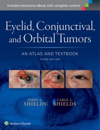 Eyelid, Conjunctival, and Orbital Tumors: An Atlas and Textbook 