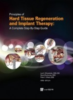 Principles of Hard Tissue Regeneration and Implant Therapy: A complete Step-By-Step Guide