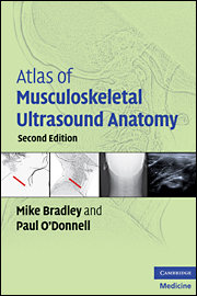 Atlas of Musculoskeletal Ultrasound Anatomy, 2/e