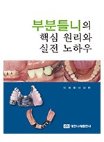 (실전보철임상시리즈 Ⅲ) 부분틀니의 핵심 원리와 실전 노하우 