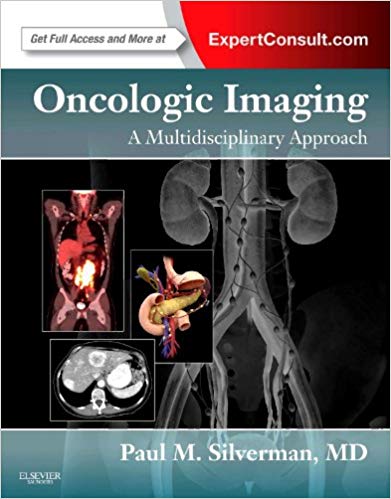 Oncologic Imaging: A Multidisciplinary Approach: Expert Consult - Online and Print